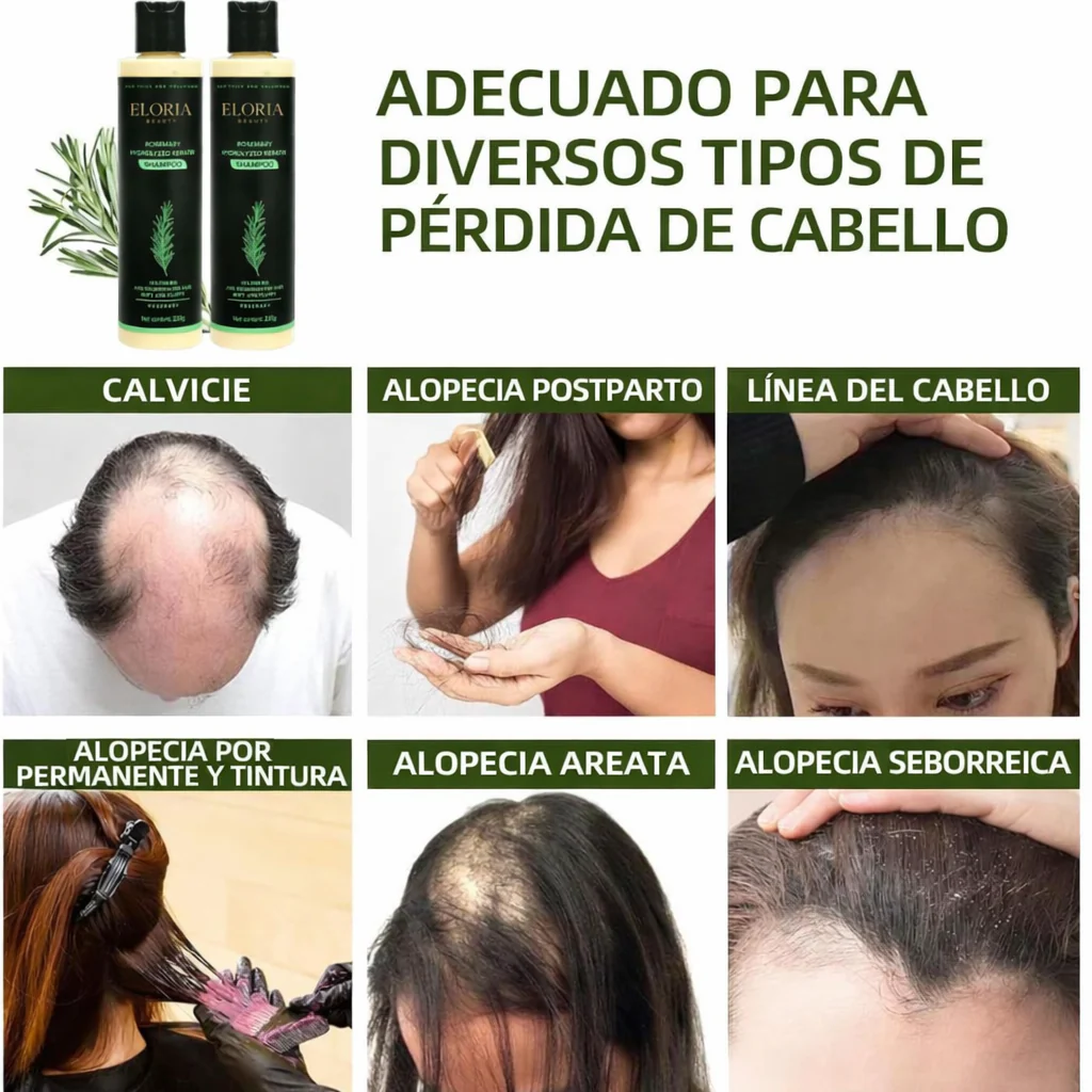 Champú orgánico de romero para el crecimiento del cabello - Image 3