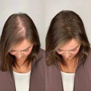 Champú orgánico de romero para el crecimiento del cabello - Image 8